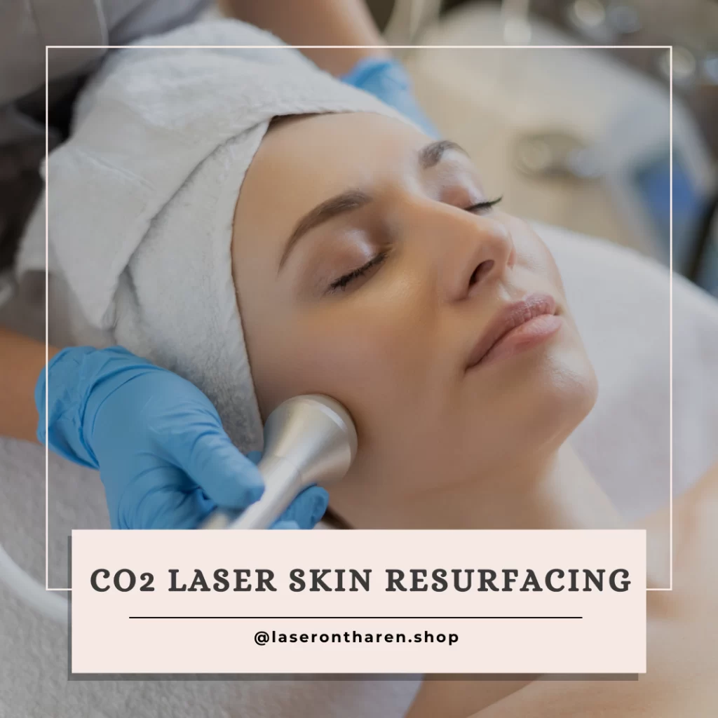 CO2 Laser Skin Resurfacing