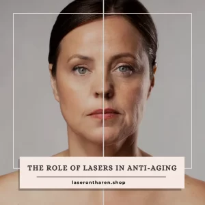 The Role of Lasers in Anti-Aging
