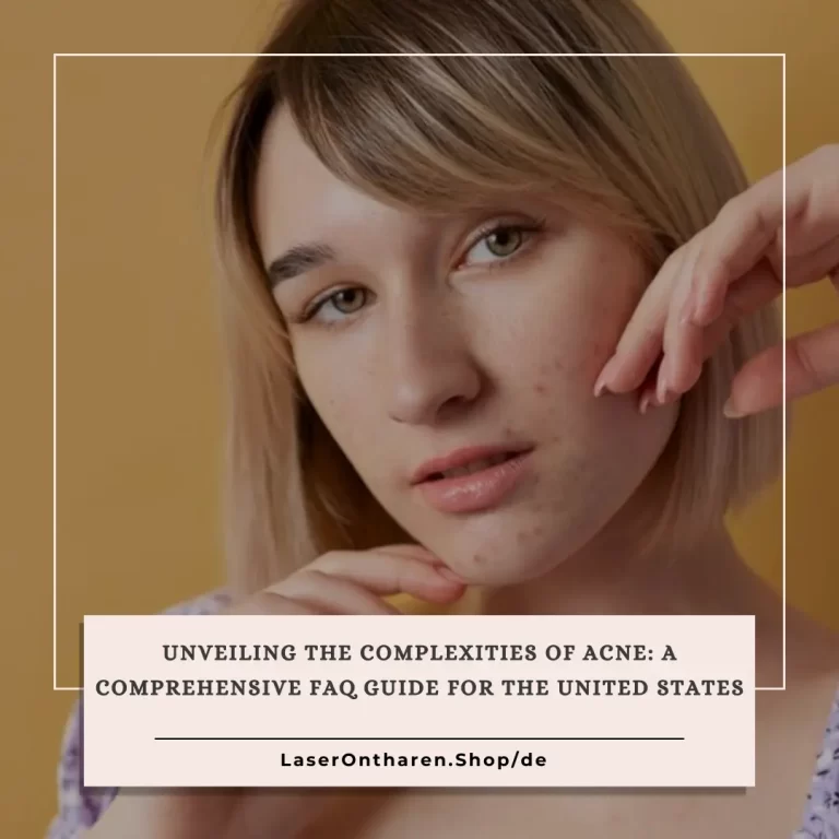 Acne FAQ