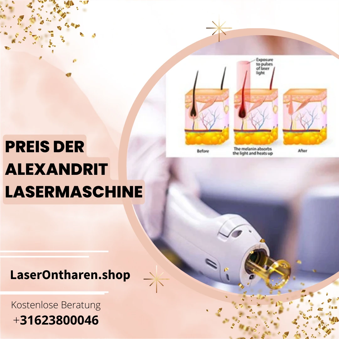 Preis der Alexandrit Lasermaschine