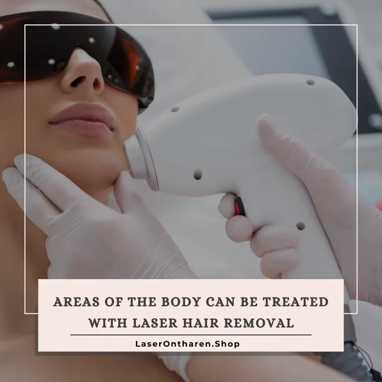 areas of the body can be treated with laser hair removal