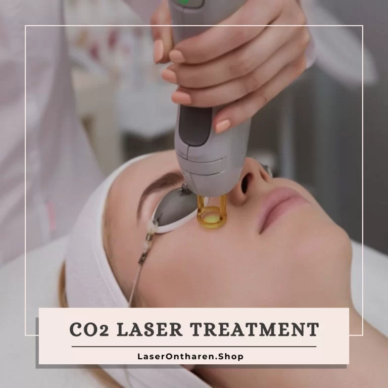 an image related to CO2 Laser Treatment - CO2-Laser-Treatment