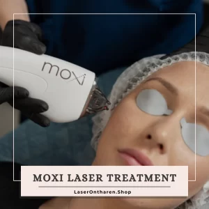 a related image to Blog - Moxi laser treatment