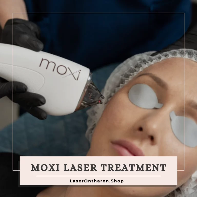 a related image to Home - Moxi laser treatment